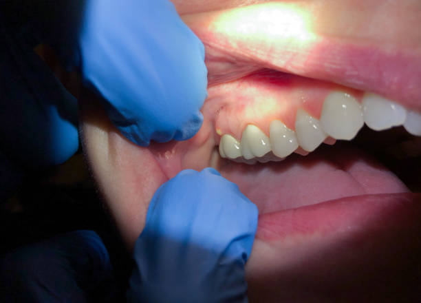 Best Walk-In Emergency Dentist in Lucedale, MS