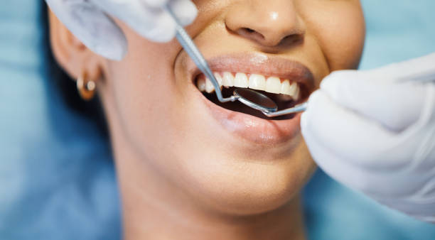 Best Emergency Broken Tooth Repair in Lucedale, MS