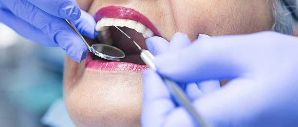 Best Emergency Tooth Extraction in Lucedale, MS